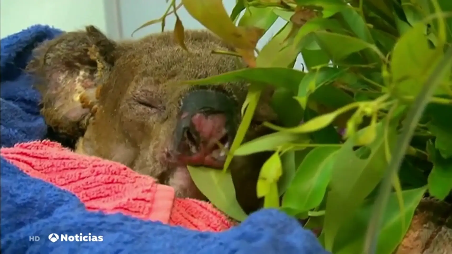 El koala rescatado en medio de las llamas se recupera en un hospital de Australia