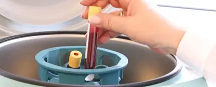 Análisis de sangre Análisis de sangre