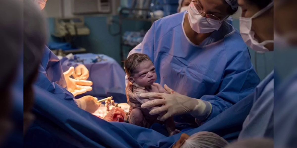 Isabela, la bebé que nació enfadada se vuelve viral