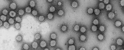 Resultado prometedor de un farmaco contra el mieloma que logra frenar un coronavirus humano Resultado prometedor de un farmaco contra el mieloma que logra frenar un coronavirus humano