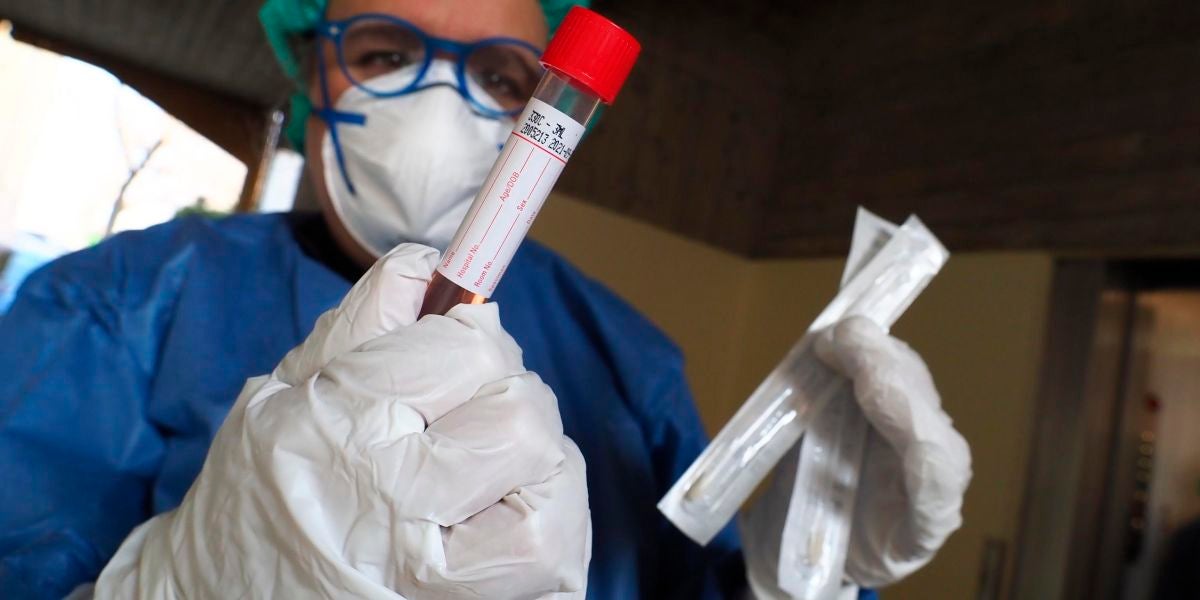 Prueba de diagnóstico del coronavirus