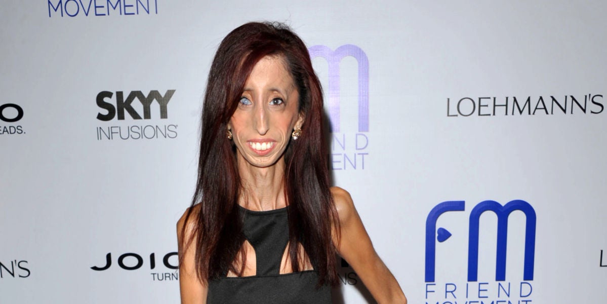 La activista Lizzie Velasquez