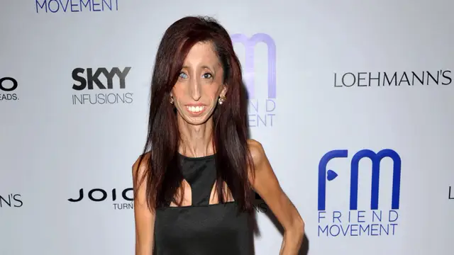 La activista Lizzie Velasquez