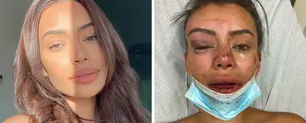 La modelo Yasmine Pierards relata la agresión que sufrido La modelo Yasmine Pierards relata la agresión que sufrido