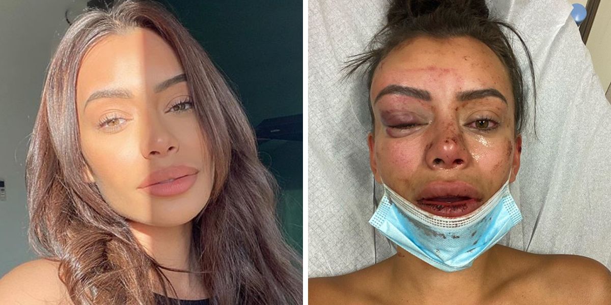 La modelo Yasmine Pierards relata la agresión que sufrido