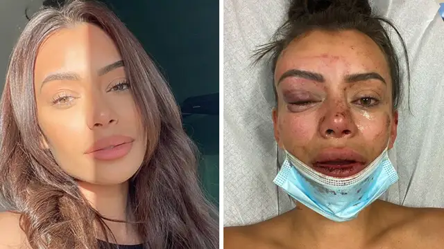 La modelo Yasmine Pierards relata la agresión que sufrido
