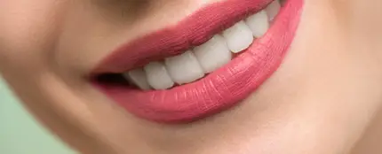 Sonrisa con los dientes blancos Sonrisa con los dientes blancos