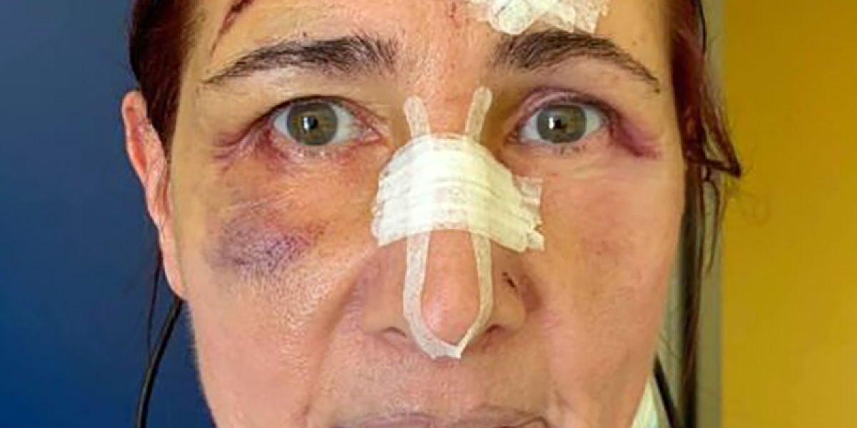 Stefania Buonpensiero, la mujer agredida