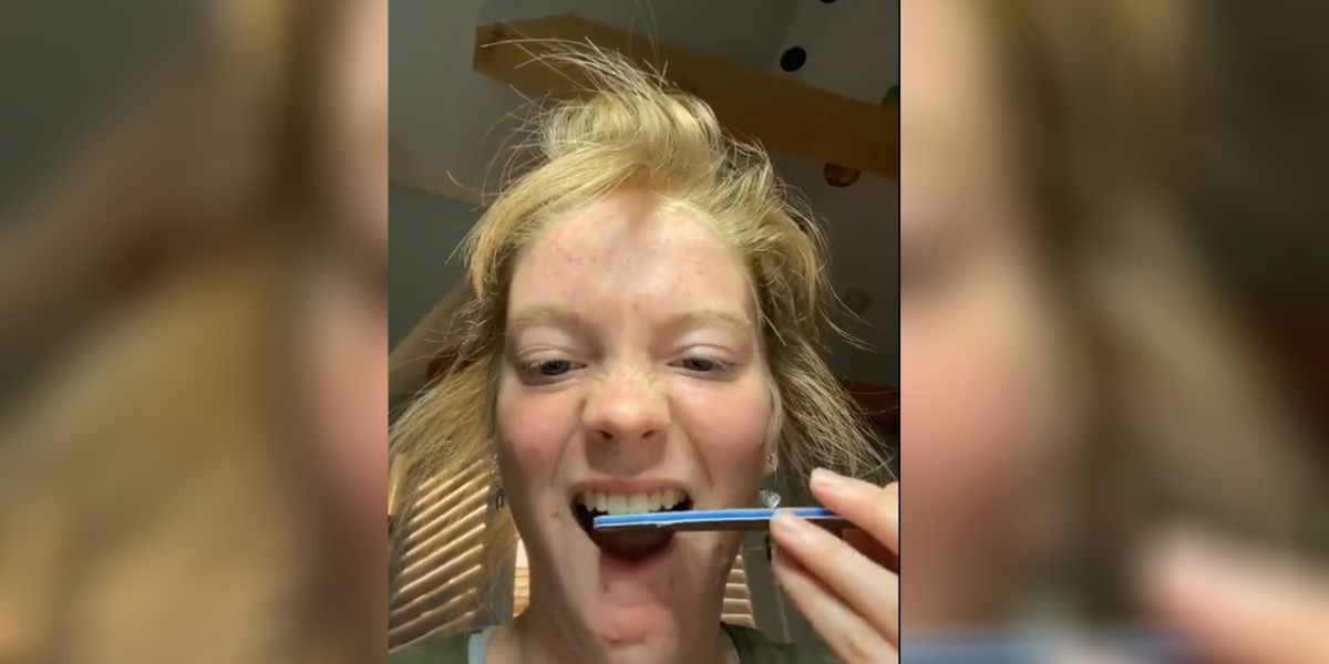 La peligrosa moda de limarse los dientes