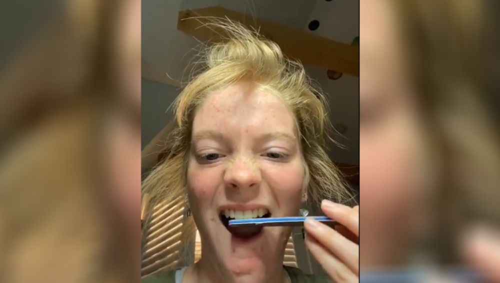 La peligrosa moda de limarse los dientes