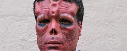 El hombre que se ha operado para parecerse a Red Skull, el villano de Capitán América El hombre que se ha operado para parecerse a Red Skull, el villano de Capitán América