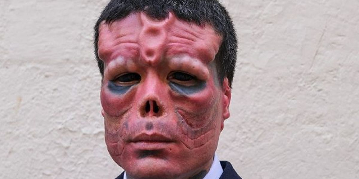 El hombre que se ha operado para parecerse a Red Skull, el villano de Capitán América