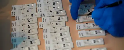 Imagen de los test rápidos para detectar anticuerpos Imagen de los test rápidos para detectar anticuerpos