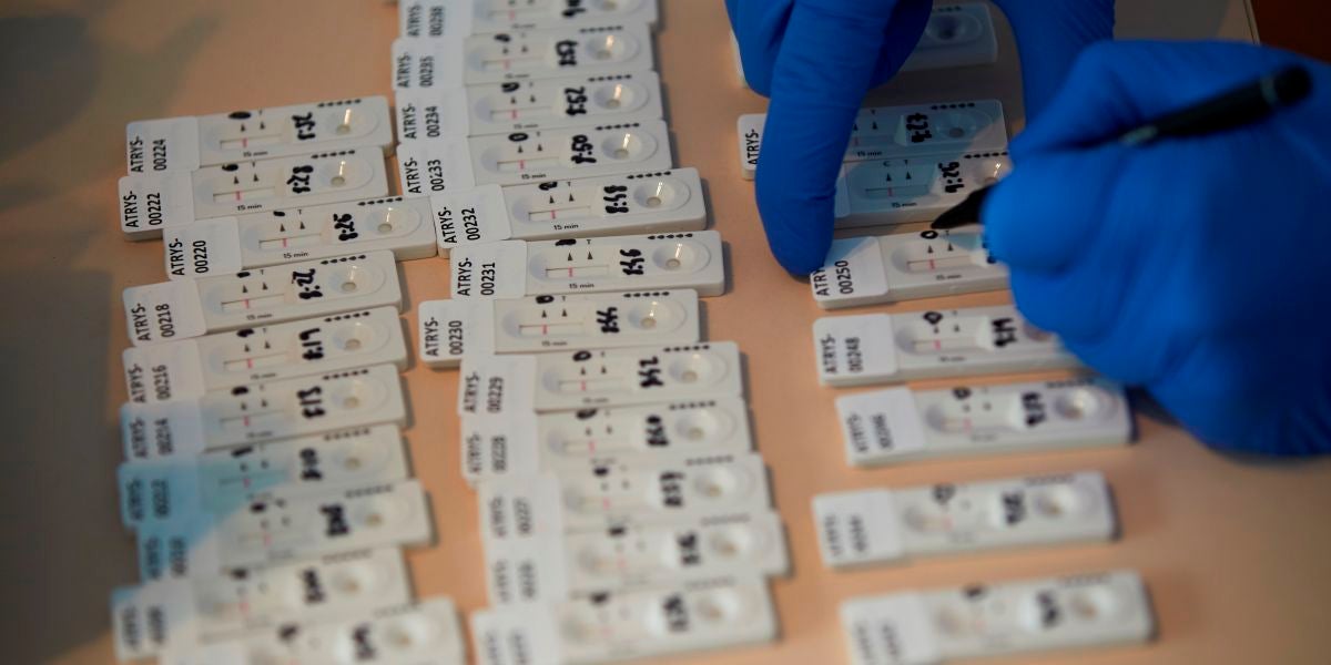 Imagen de los test rápidos que recibirán las farmacias para detectar anticuerpos