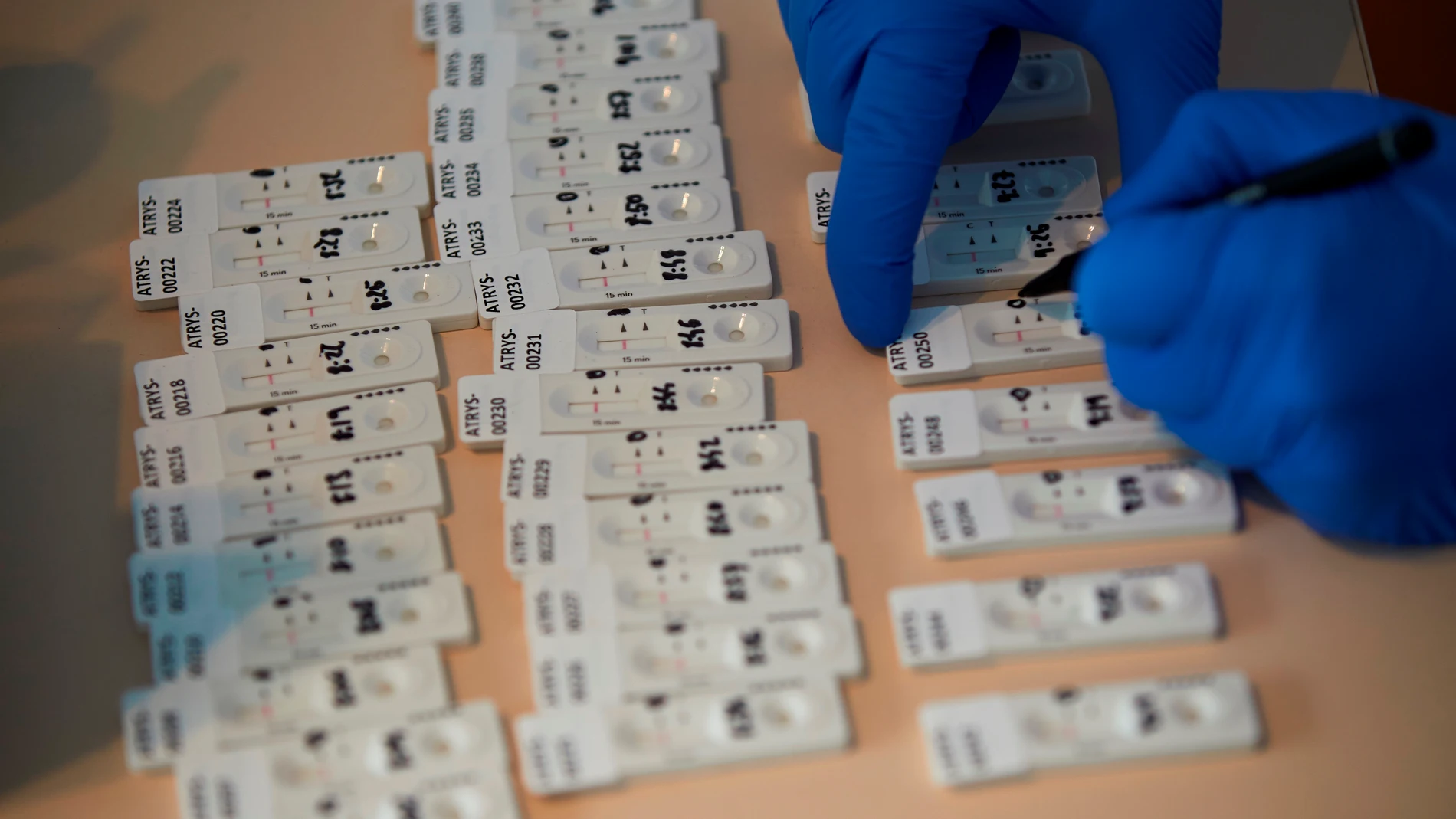 Imagen de los test rápidos para detectar anticuerpos Imagen de los test rápidos para detectar anticuerpos