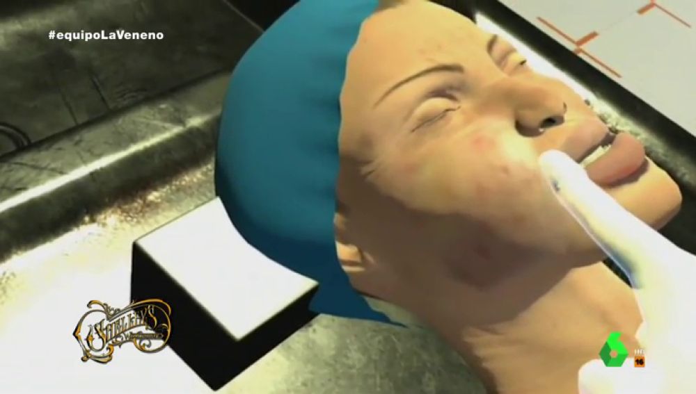 La recreación en 3D de La Veneno que probaría que la muerte no fue accidental: "Hay golpes de un posible agarre efectuado por el agresor"