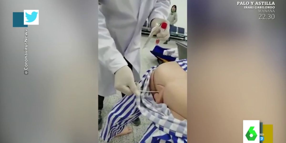 test anal