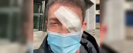 Pablo Motos con un ojo vendado Pablo Motos con un ojo vendado