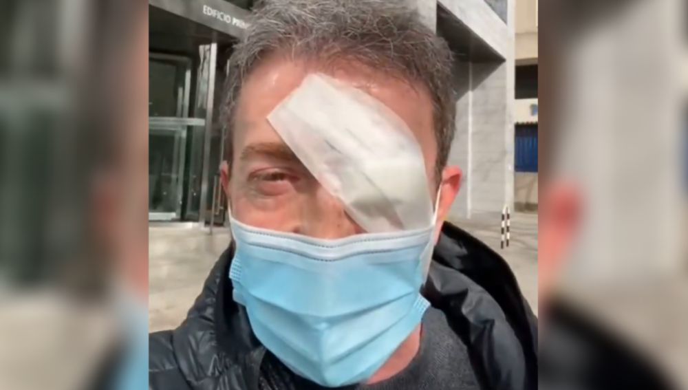 Pablo Motos con un ojo vendado