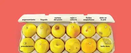 Los 12 señales para detectar el cáncer de mama Los 12 señales para detectar el cáncer de mama