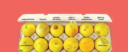 Los 12 señales para detectar el cáncer de mama Los 12 señales para detectar el cáncer de mama