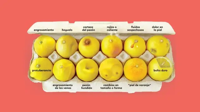 Los 12 señales para detectar el cáncer de mama