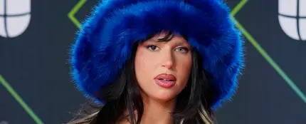 Por qué Nathy Peluso tiene los ojos de distinto color Por qué Nathy Peluso tiene los ojos de distinto color