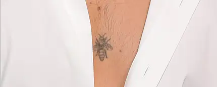 ¿Qué famoso cantante tiene tatuada una abeja en el pecho? ¿Qué famoso cantante tiene tatuada una abeja en el pecho?