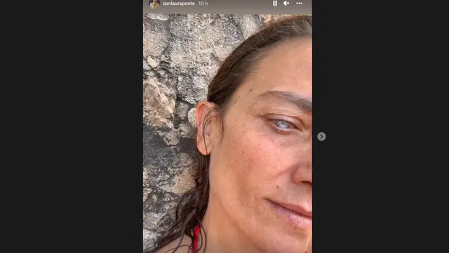 Laura Ponte muestra su ojo dañado tras sufrir una perforación de la córnea