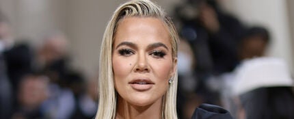 Khloé Kardashian revela que le ha quitado un extraño tumor de la cara 
