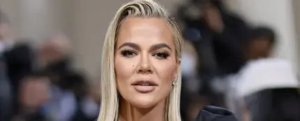 Khloé Kardashian revela que le ha quitado un extraño tumor de la cara Khloé Kardashian revela que le ha quitado un extraño tumor de la cara