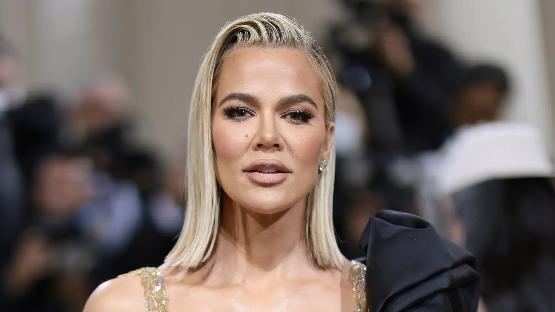 Khloé Kardashian revela que le ha quitado un extraño tumor de la cara 
