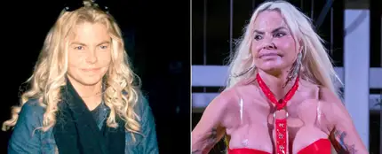El antes y el después de Leticia Sabater. El antes y el después de Leticia Sabater.