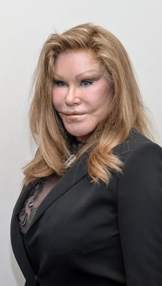 Jocelyn Wildenstein Jocelyn Wildenstein
