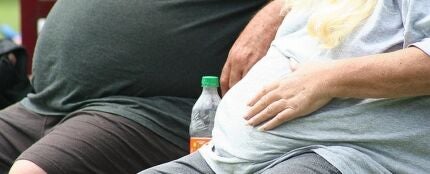 Obesidad y sobrepeso