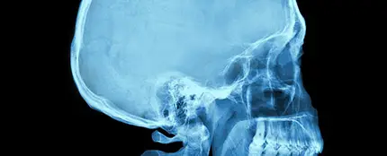 Sin cerebro Sin cerebro