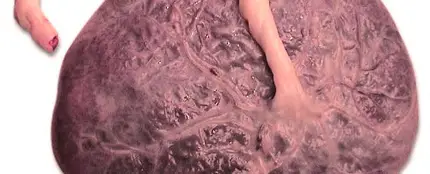 A la rica placenta... A la rica placenta...
