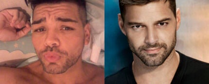 Se opera para parecerse a Ricky Martin