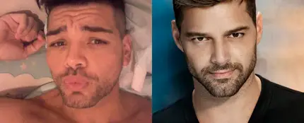 Se opera para parecerse a Ricky Martin Se opera para parecerse a Ricky Martin