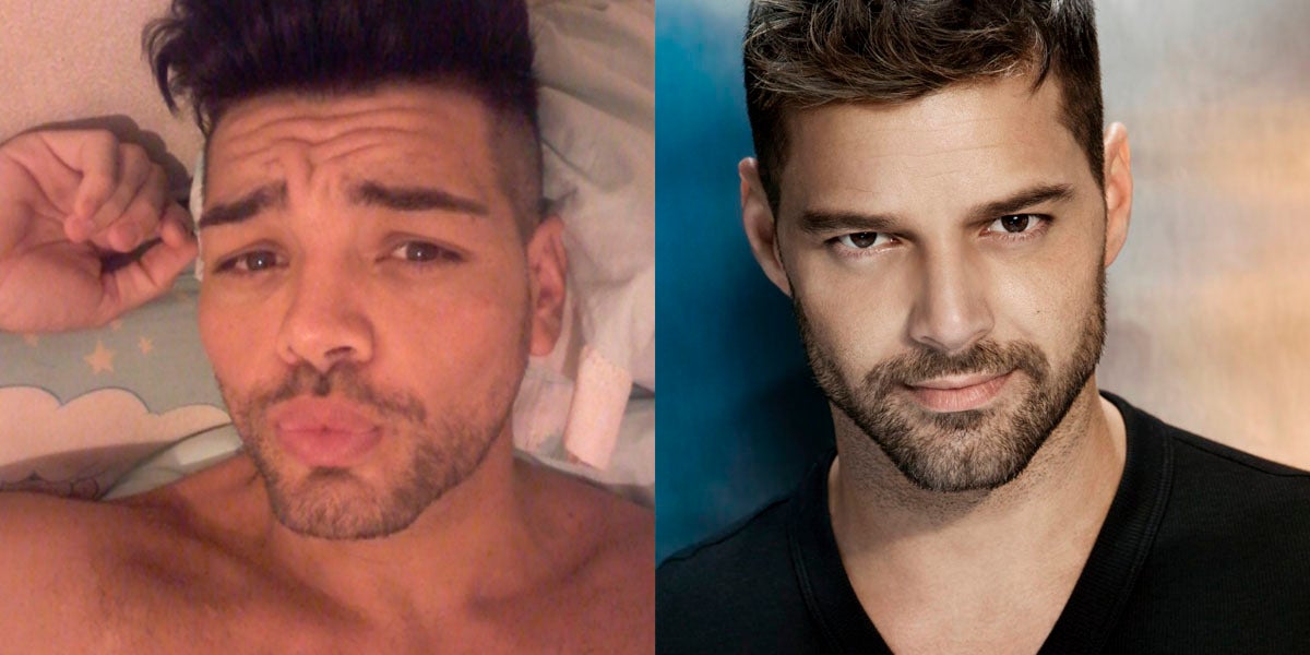Se opera para parecerse a Ricky Martin