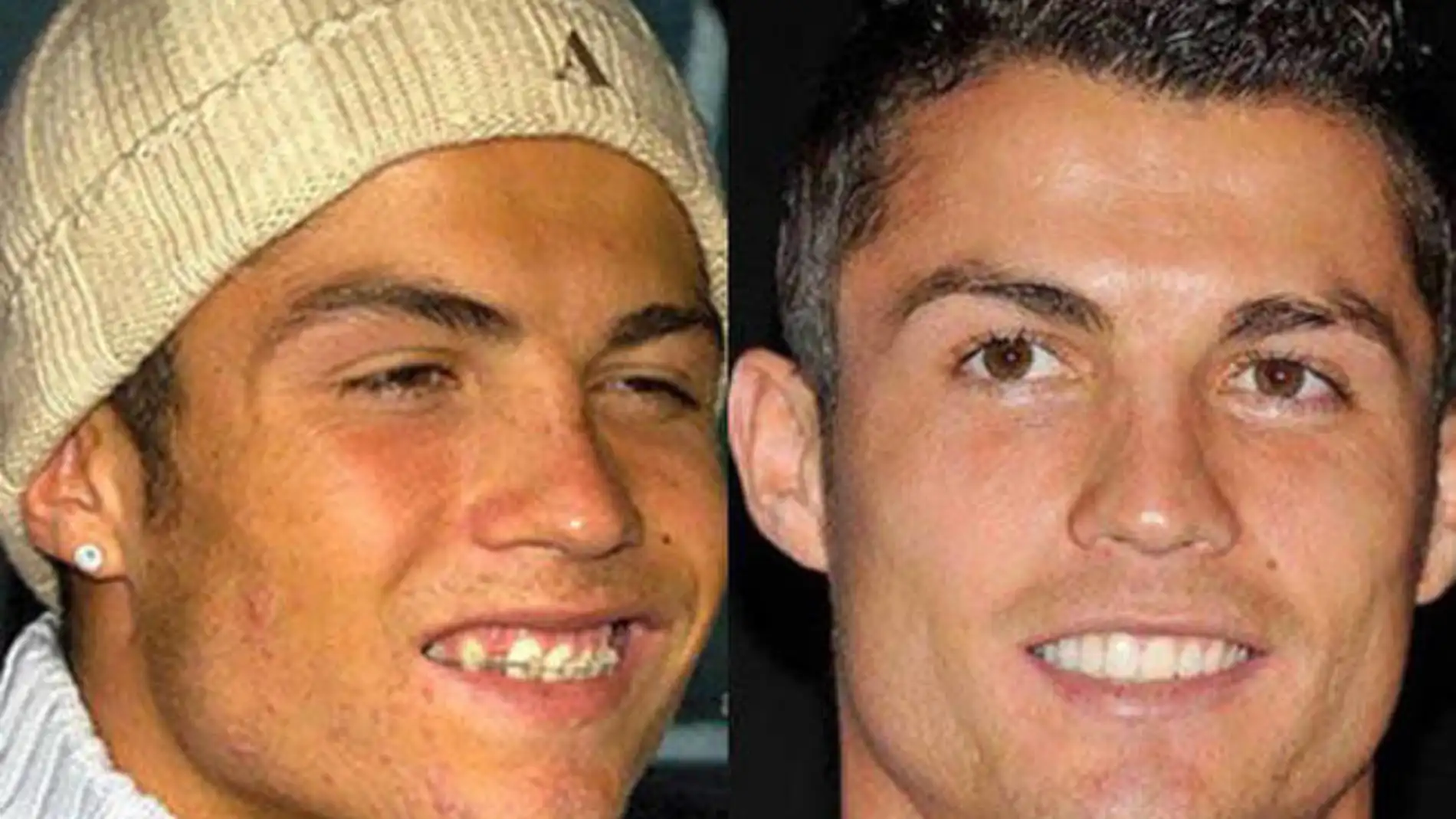 Cristiano Ronaldo, antes y después