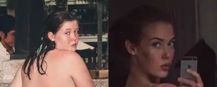 El antes y después de Mathilde Broberg El antes y después de Mathilde Broberg