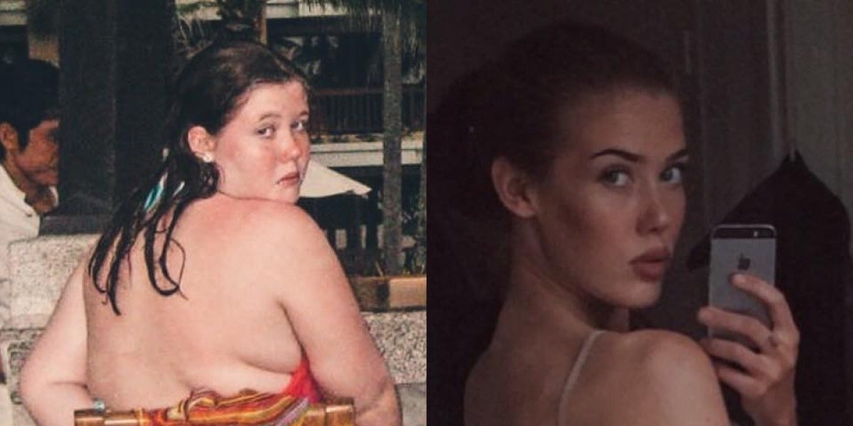 El antes y después de Mathilde Broberg