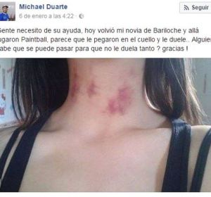 Un chico pide ayuda por los moratones de su novia y la red le explica que son chupetones Un chico pide ayuda por los moratones de su novia y la red le explica que son chupetones