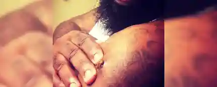 El rapero se saca una bala del brazo El rapero se saca una bala del brazo