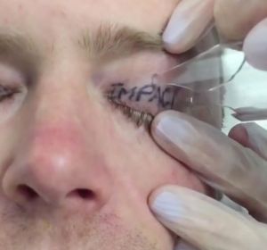Tatuado tras una noche de fiesta Tatuado tras una noche de fiesta
