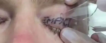 Tatuado tras una noche de fiesta Tatuado tras una noche de fiesta