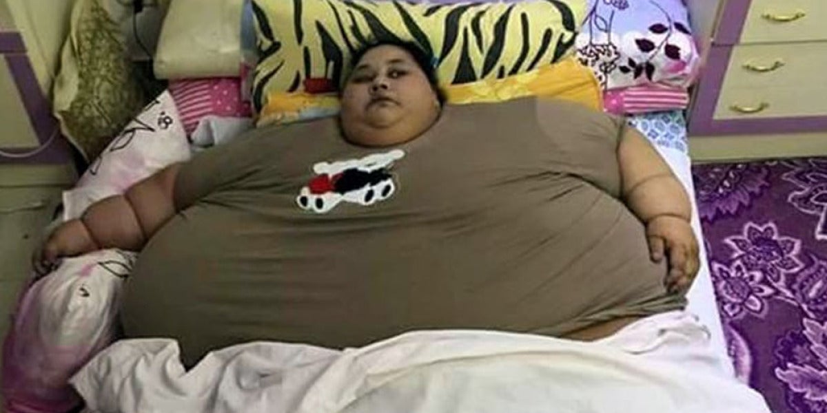 Eman Ahmed, la mujer más obesa del mundo