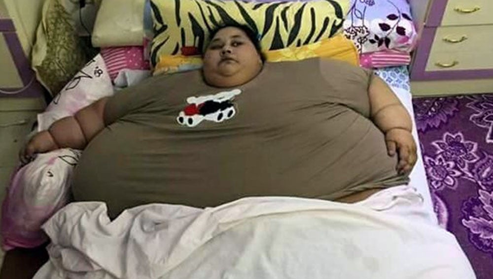 La mujer más gorda del recibe el alta de adelgazar 300 kilos Europa FM