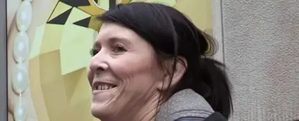 Zara Hartshorn sufre lipodistrofia, una enfermedad rara que hace que su piel no tenga elasticidad Zara Hartshorn sufre lipodistrofia, una enfermedad rara que hace que su piel no tenga elasticidad